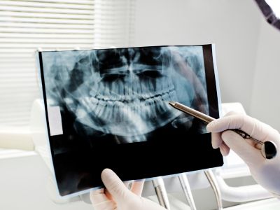 تصویربرداری خارج دهانی