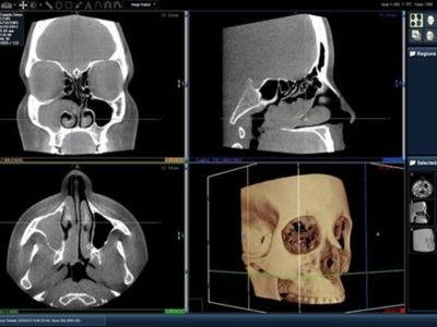 سی تی اسکن و تصویربرداری سه بعدی
