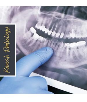 چه زمانی انجام عکس OPG توصیه میشود؟ چه زمانی انجام عکس OPG توصیه میشود؟