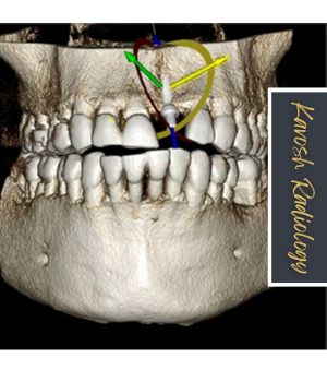 مزایای تصویربرداری Dental CBCT مزایای تصویربرداری Dental CBCT