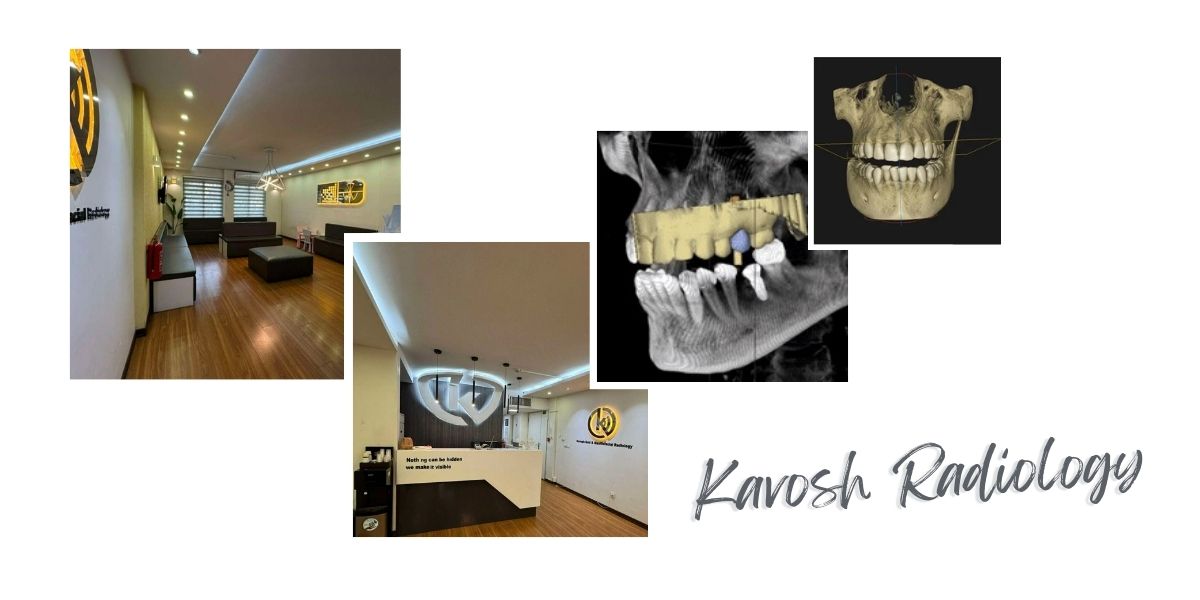 چرا مرکز کاوش بهترین مرکز عکس سه بعدی دندان (CBCT) در شمال تهران است؟ چرا مرکز کاوش بهترین مرکز عکس سه بعدی دندان (CBCT) در شمال تهران است؟