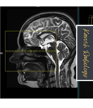 کاربردهای CT اسکن سینوس پیشانی کاربردهای CT اسکن سینوس پیشانی