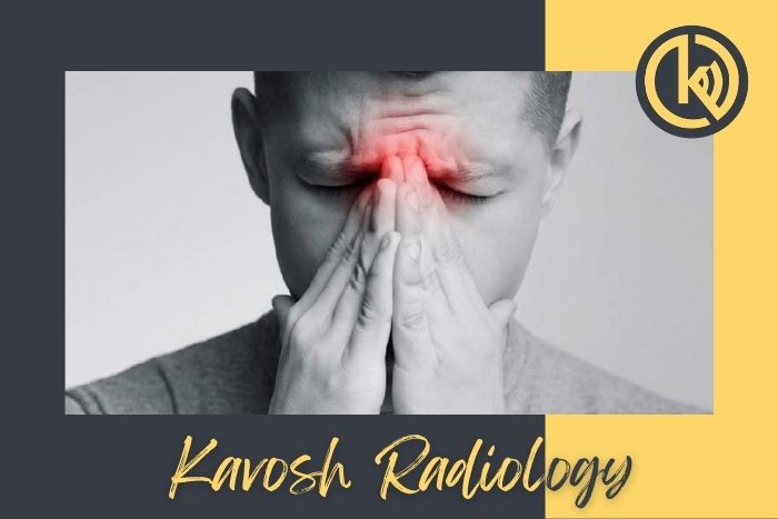 بررسی تشخیص درد سینوس با عکس دندان یا CT 
